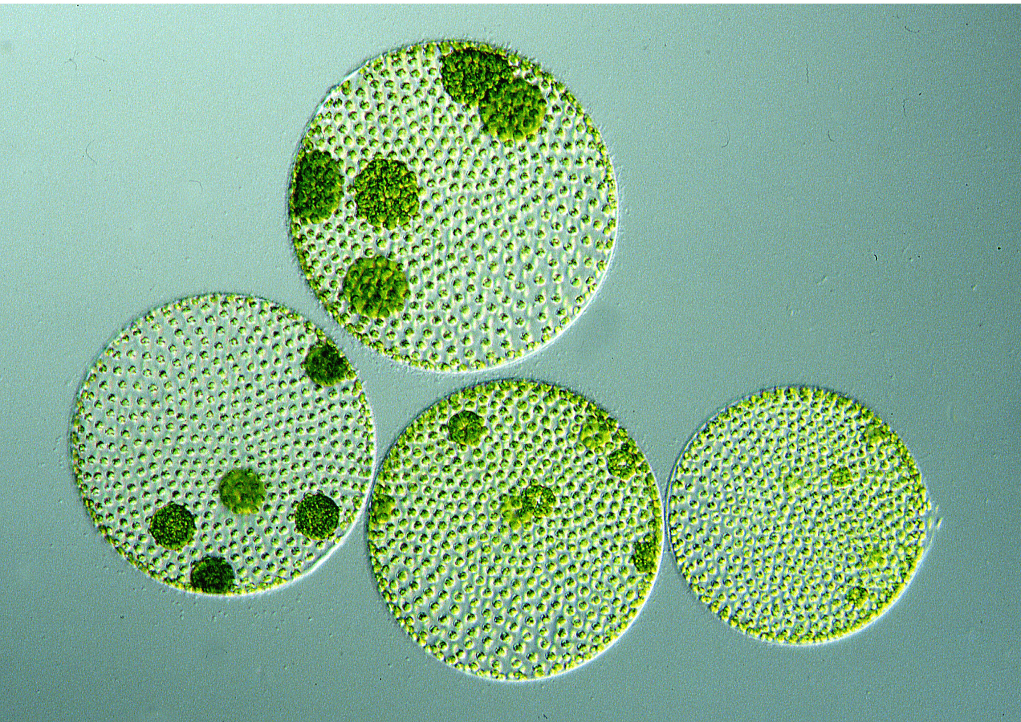 Microscopic algae cells in ALBON treatment system