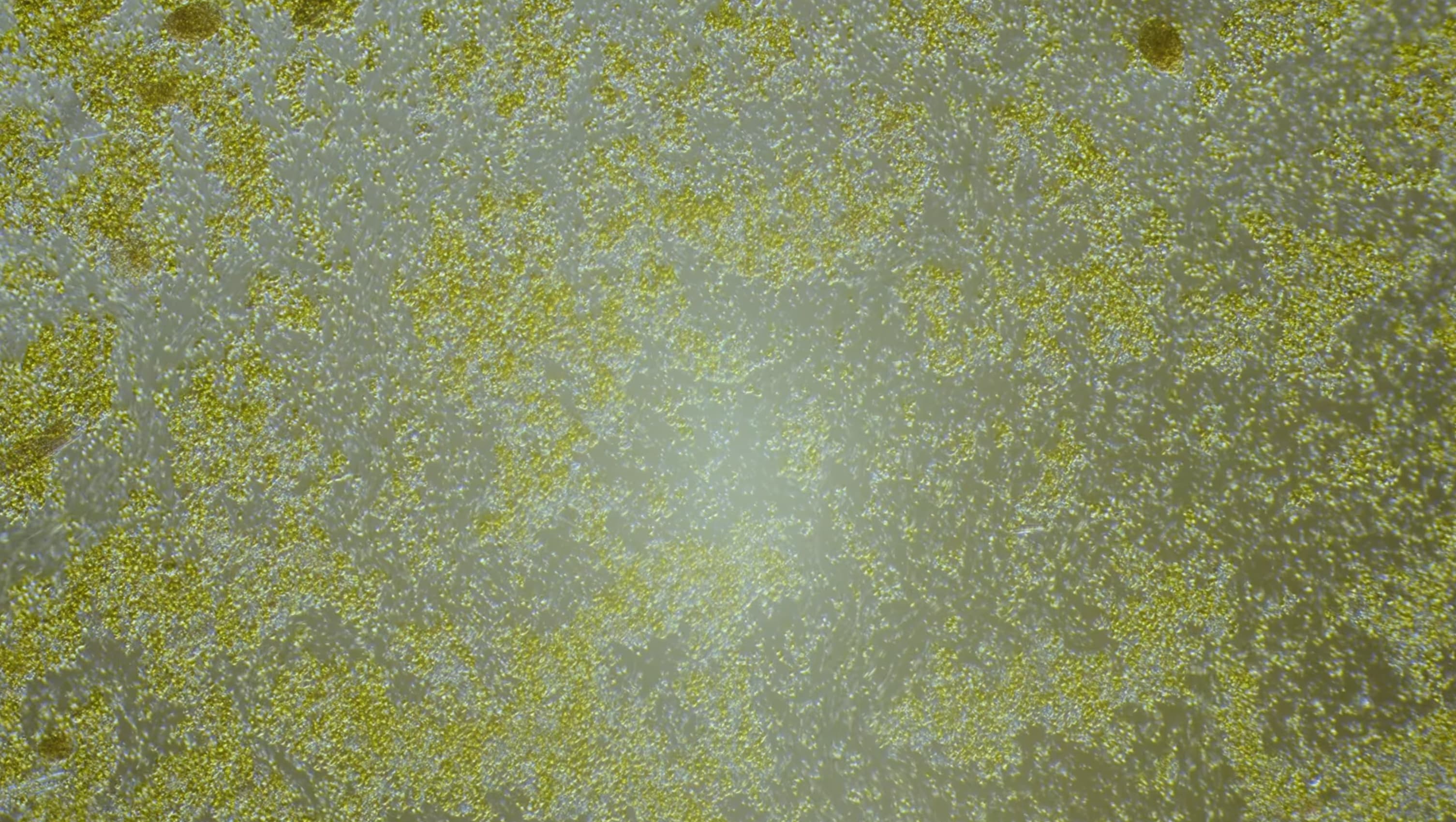 Microscopic algae cells causing eutrophication